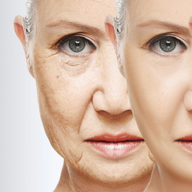 antiaging-e